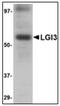 Leucine-rich repeat LGI family member 3 antibody, AP23843PU-N, Origene, Western Blot image 
