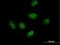 RPA Interacting Protein antibody, H00084268-B01P, Novus Biologicals, Immunofluorescence image 
