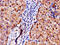 ADAM Metallopeptidase With Thrombospondin Type 1 Motif 4 antibody, CSB-PA001311LA01HU, Cusabio, Immunohistochemistry frozen image 