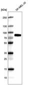 5,6-dihydroxyindole-2-carboxylic acid oxidase antibody, AMAb91327, Atlas Antibodies, Western Blot image 