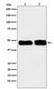 Complement Component 4 Binding Protein Beta antibody, M08320, Boster Biological Technology, Western Blot image 