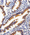 SH2 domain-containing adapter protein B antibody, A02109-1, Boster Biological Technology, Immunohistochemistry paraffin image 