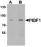 Progesterone Immunomodulatory Binding Factor 1 antibody, PA5-34514, Invitrogen Antibodies, Western Blot image 