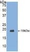 Ribonuclease A Family Member 3 antibody, abx101663, Abbexa, Western Blot image 