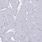 Calmodulin-like protein 5 antibody, PA5-59268, Invitrogen Antibodies, Immunohistochemistry frozen image 
