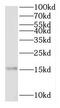 Ribosomal Protein L28 antibody, FNab07428, FineTest, Western Blot image 
