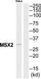 Msh Homeobox 2 antibody, TA314214, Origene, Western Blot image 