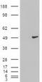 KRT18 antibody, TA500016S, Origene, Western Blot image 