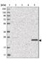 Homeobox protein DLX-6 antibody, NBP1-85929, Novus Biologicals, Western Blot image 