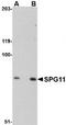 SPG11 Vesicle Trafficking Associated, Spatacsin antibody, TA306723, Origene, Western Blot image 