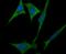 Unc-51 Like Autophagy Activating Kinase 1 antibody, NBP2-80424, Novus Biologicals, Immunofluorescence image 