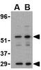 Dug antibody, GTX31750, GeneTex, Western Blot image 