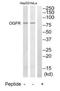 Opioid growth factor receptor antibody, TA315145, Origene, Western Blot image 