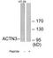 Actinin Alpha 3 (Gene/Pseudogene) antibody, TA313420, Origene, Western Blot image 