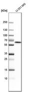 UDP-N-acetylhexosamine pyrophosphorylase antibody, HPA014659, Atlas Antibodies, Western Blot image 