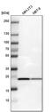 Ribosomal Protein L10 antibody, PA5-52816, Invitrogen Antibodies, Western Blot image 
