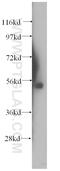 Sushi Repeat Containing Protein X-Linked 2 antibody, 11845-1-AP, Proteintech Group, Western Blot image 