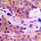 Phospholipase C Gamma 2 antibody, LS-C352674, Lifespan Biosciences, Immunohistochemistry frozen image 