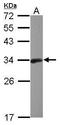 BCL10 Immune Signaling Adaptor antibody, GTX112744, GeneTex, Western Blot image 