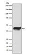NFKB Inhibitor Epsilon antibody, M07073, Boster Biological Technology, Western Blot image 