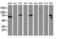 Catenin Beta 1 antibody, LS-C172581, Lifespan Biosciences, Western Blot image 