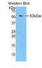 Kallikrein-6 antibody, LS-C300993, Lifespan Biosciences, Western Blot image 