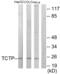 HRF antibody, abx013390, Abbexa, Western Blot image 