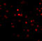 Regulating Synaptic Membrane Exocytosis 3 antibody, A13058, Boster Biological Technology, Immunofluorescence image 