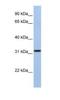 Solute Carrier Family 25 Member 28 antibody, NBP1-59562, Novus Biologicals, Western Blot image 