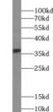 CD326 / EpCAM antibody, FNab09783, FineTest, Western Blot image 