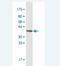 EPH Receptor A1 antibody, H00002041-M14-100ug, Novus Biologicals, Western Blot image 