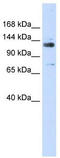 SPIN antibody, TA344495, Origene, Western Blot image 