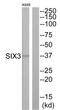 Homeobox protein SIX3 antibody, TA314537, Origene, Western Blot image 