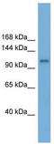 HECT And RLD Domain Containing E3 Ubiquitin Protein Ligase Family Member 6 antibody, TA329870, Origene, Western Blot image 