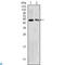 3-Hydroxybutyrate Dehydrogenase 1 antibody, LS-C812507, Lifespan Biosciences, Immunohistochemistry paraffin image 