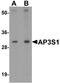 AP-3 complex subunit sigma-1 antibody, A12249, Boster Biological Technology, Western Blot image 