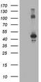 CCM2 Scaffold Protein antibody, LS-C786338, Lifespan Biosciences, Western Blot image 