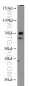 Nuclear factor 1 A-type antibody, 11750-1-AP, Proteintech Group, Western Blot image 
