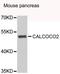 Calcium-binding and coiled-coil domain-containing protein 2 antibody, A7358, ABclonal Technology, Western Blot image 