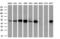 Proteasome 26S Subunit, ATPase 3 antibody, GTX83783, GeneTex, Western Blot image 