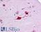 Fatty Acid Binding Protein 4 antibody, LS-B4574, Lifespan Biosciences, Immunohistochemistry frozen image 