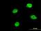 Bromodomain Containing 8 antibody, MA5-21186, Invitrogen Antibodies, Immunofluorescence image 