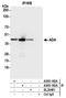 ADA1 antibody, A305-183A, Bethyl Labs, Immunoprecipitation image 