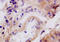 Tenascin C antibody, 251411, Abbiotec, Immunohistochemistry paraffin image 