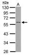 Angiopoietin-related protein 3 antibody, PA5-28058, Invitrogen Antibodies, Western Blot image 