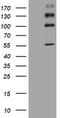 ALK Receptor Tyrosine Kinase antibody, TA801294S, Origene, Western Blot image 