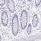 Cysteine Dioxygenase Type 1 antibody, HPA057503, Atlas Antibodies, Immunohistochemistry paraffin image 