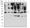 Killer cell immunoglobulin-like receptor 3DL1 antibody, NBP2-61805, Novus Biologicals, Western Blot image 