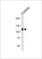Phosphatase and actin regulator 4 antibody, 64-178, ProSci, Western Blot image 