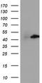 Centromere Protein H antibody, LS-C337543, Lifespan Biosciences, Western Blot image 